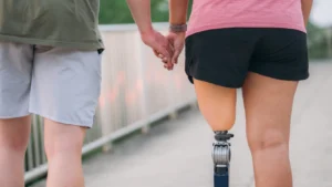 Articles 1 Amputee Walking with Partner Female 19QaAvBAIn9K2hcMHo5P7DfH8P2GVb